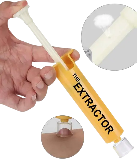 Pompe aspire venin - Kit multiusage: piqure et morsure - Extraction venin - Breizhilience.fr